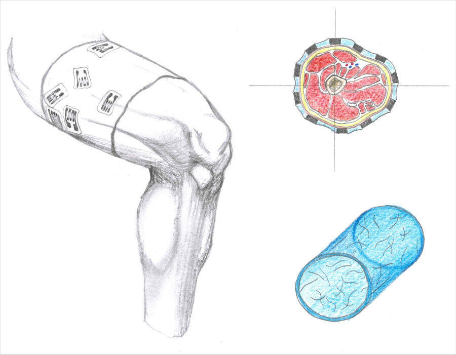 Draft of my smart thigh compression sleeve