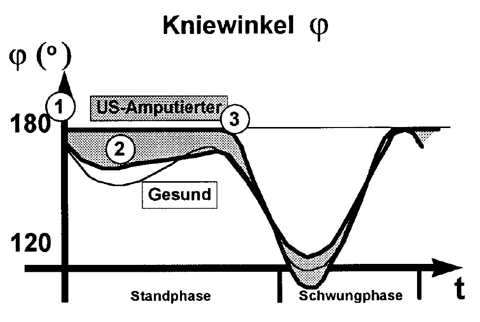 lasar-kneewinkle