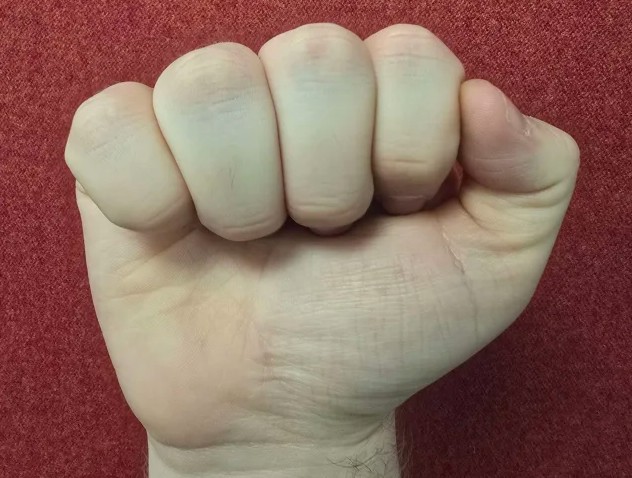 Fist