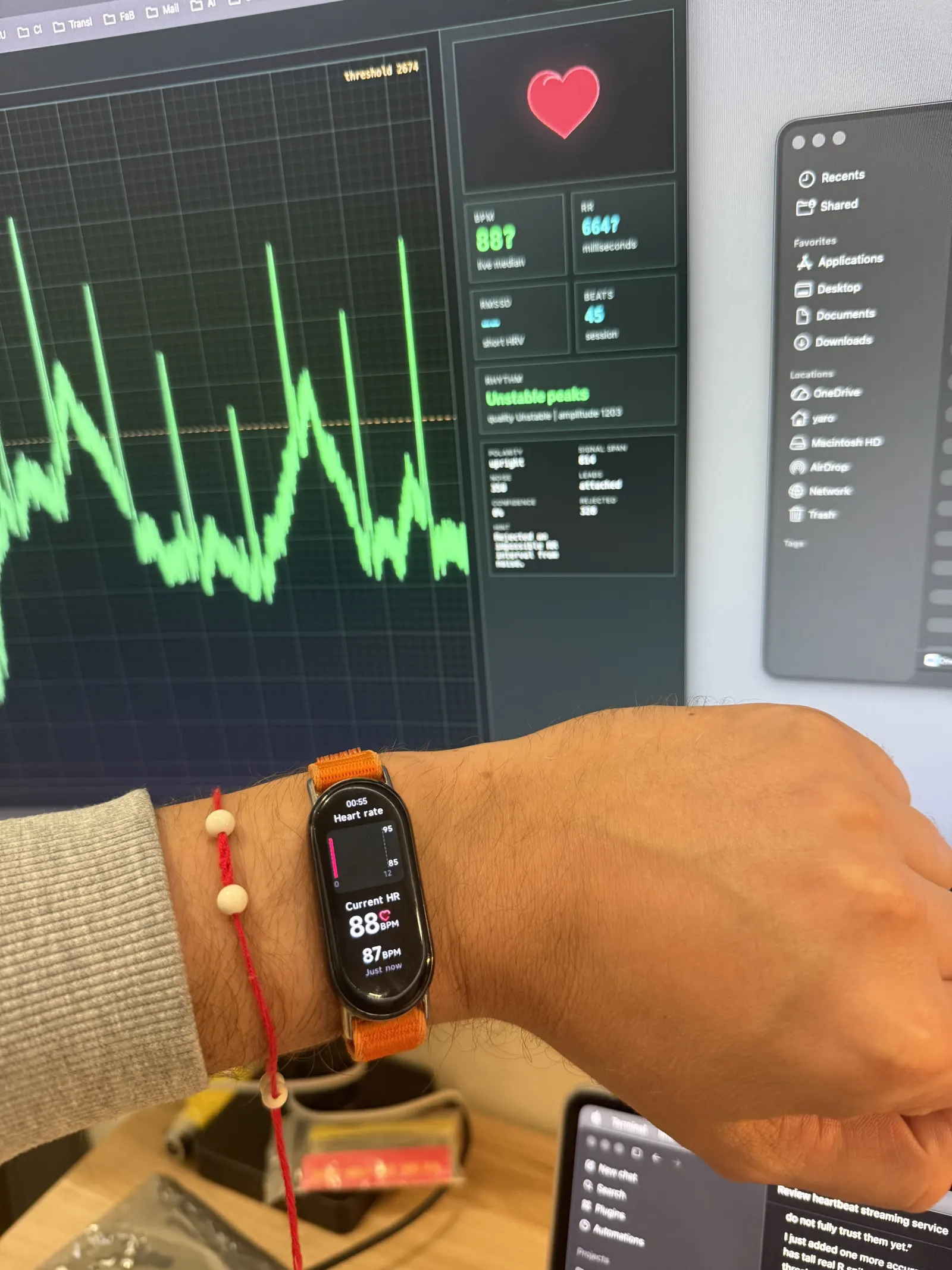 Seebscribe dashboard compared with a Xiaomi wearable heart-rate reading