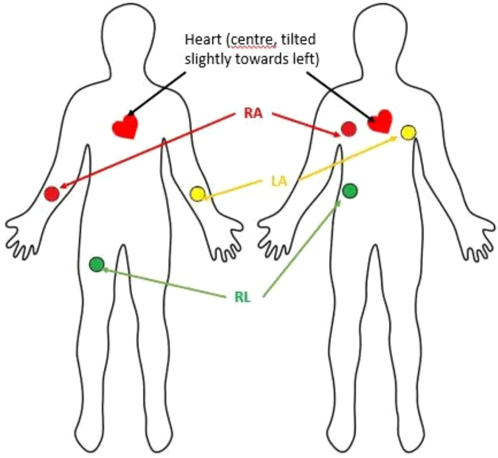 Understating ECG Sensors and How to Program AD8232 ECG Sensor with ...