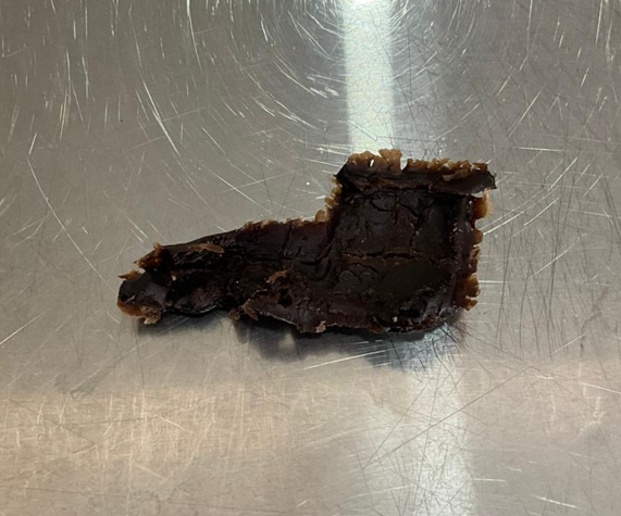 Failed biomaterial test
